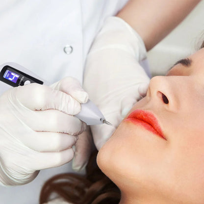 Cauterizador de Lunares PlasmaSkin Pro™