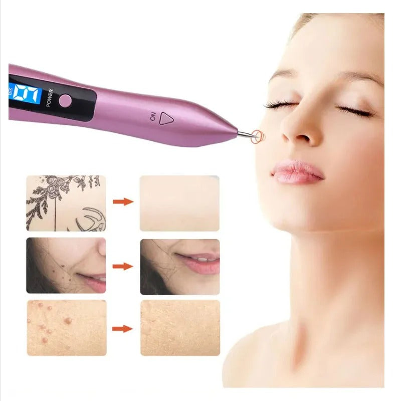 Cauterizador de Lunares PlasmaSkin Pro™