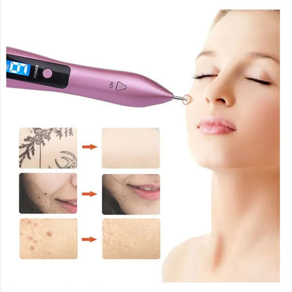 Cauterizador de Lunares PlasmaSkin Pro™